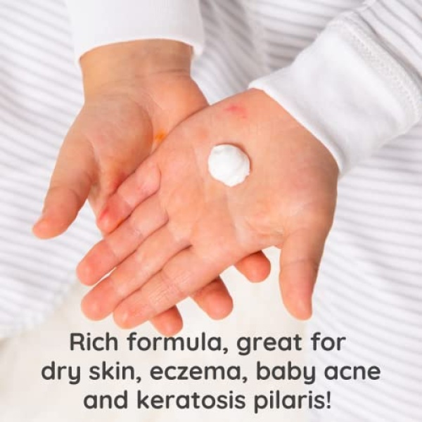 Bubbsi Whipped Coconut Oil Baby Lotion for Eczema, Dry Skin, Baby Acne - Image 3