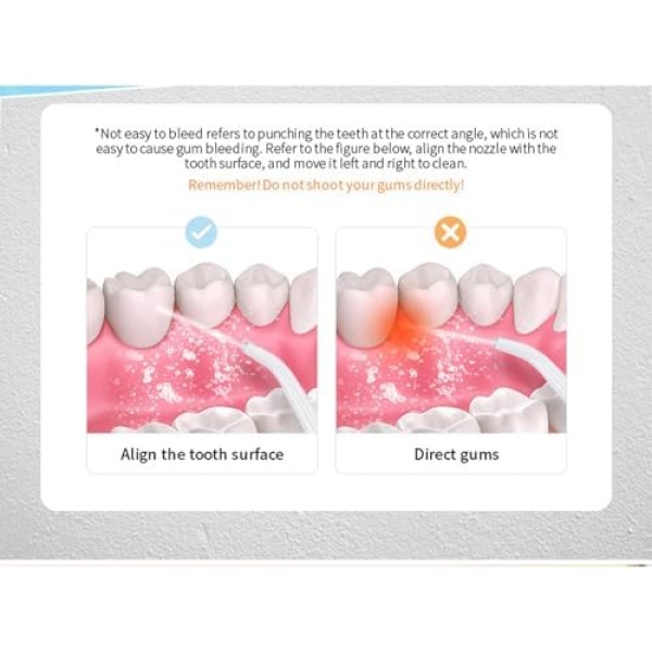Electric Irrigator, Home Portable Water Teeth Cleaning Flosser With With 4 - Image 7