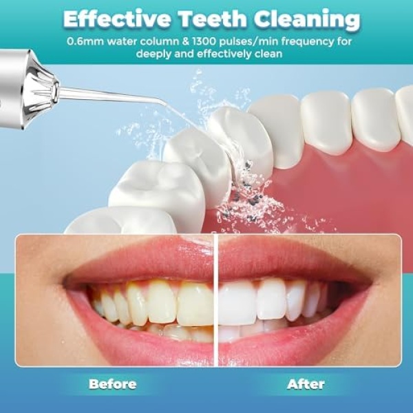Cordless Water Flosser, Dental Oral Irrigator, Waterproof Water Flosser Teeth - Image 8