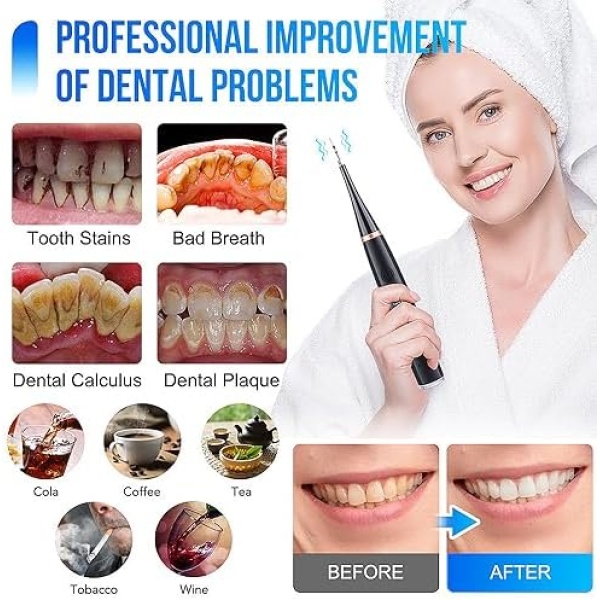 BESUNTEK IPX7 Waterproof Electric Tooth Cleaner with Mouth Mirror, Portable - Image 4